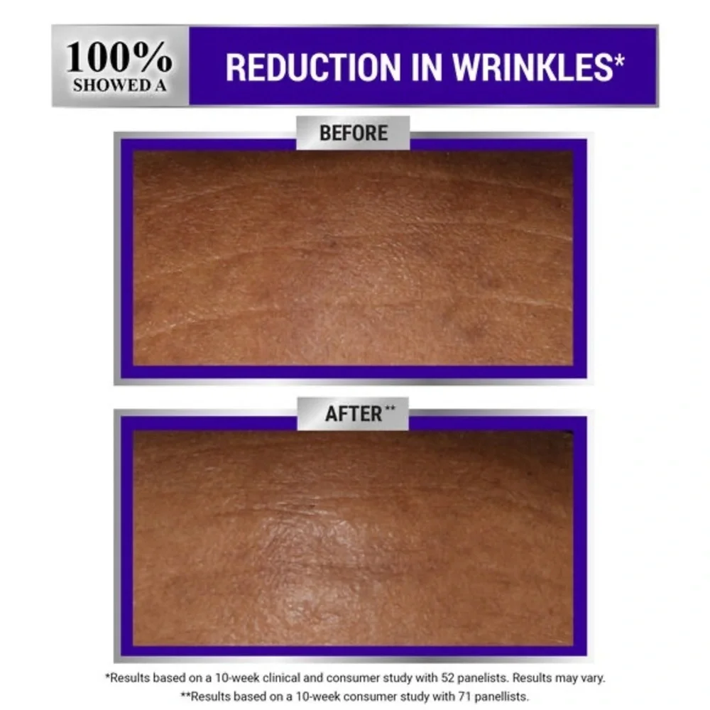 🎀 Kiehl’s Retinol Fast Release Wrinkle-Reducing Night Serum